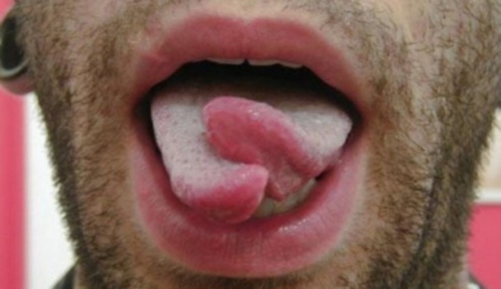 Fotografie zobrazující rozdvojený pánský jazyk