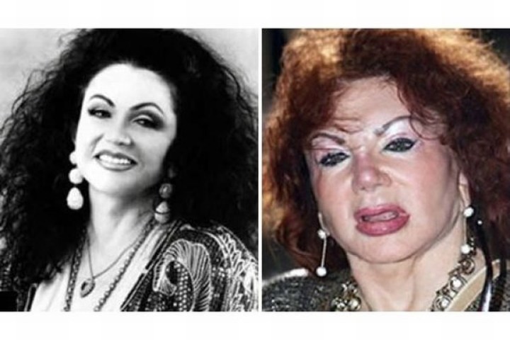Plastické operace celebrit Herečka Jackie Stallone na své propagační fotografii