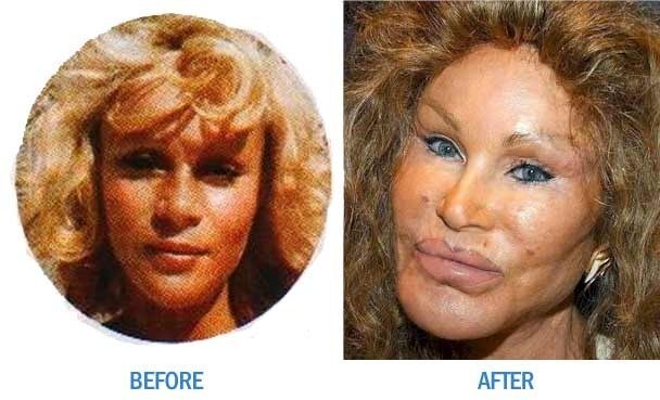 Kočičí žena - Jocelyn Wildenstein (causticcodapodcoast.com) Kočičí žena - Jocelyn Wildenstein (causticcodapodcoast.com)