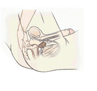 prostatetips.blogspot.com prostatetips.blogspot.com