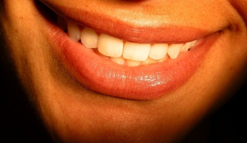 Fotografie zobrazující zářivý úsměv se zdravými zuby